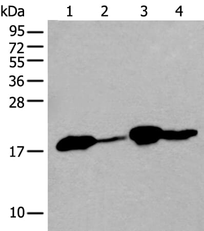 Gel: 12% SDS-PAGE Lysate: 40 &#956;g, Lane 1-4: Human heart tissue£¬PC-3 cell£¬Mouse heart tissue and Human cerebrum tissue lysates, Primary antibody: TMEM254 antibody at dilution 1/300, Secondary antibody: Goat anti rabbit IgG at 1/8000 dilution, Exposure time: 15 seconds