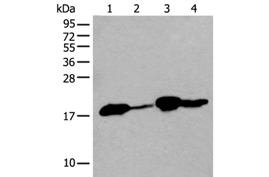 TMEM254 Antibody from Signalway Antibody (43998) - Antibodies.com