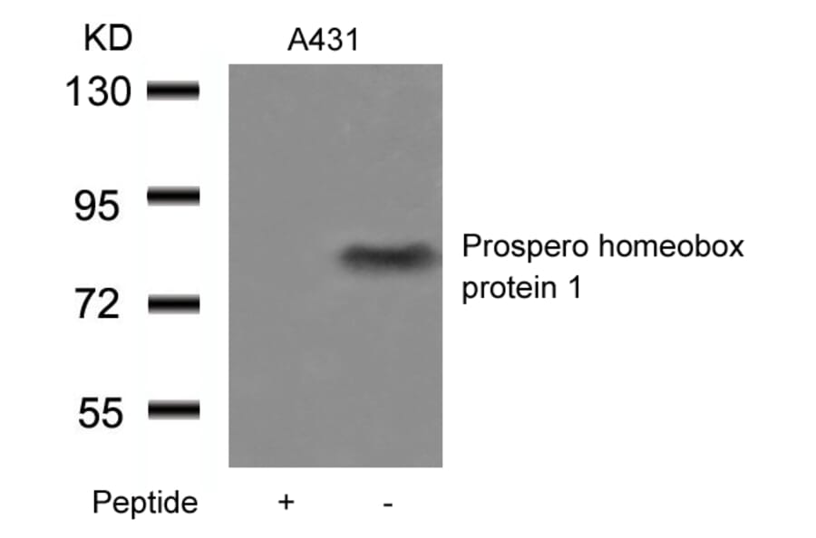 Western blot - Prospero homeobox protein 1 Antibody from Signalway Antibody (21409) - Antibodies.com