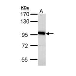 V-ATPase 116 kDa isoform a4 antibody from Signalway Antibody (22746) - Antibodies.com