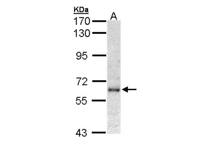 interferon-alpha receptor 1 antibody from Signalway Antibody (23025) - Antibodies.com