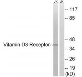 Western blot - Vitamin D3 Receptor (Ab-51) Antibody from Signalway Antibody (33256) - Antibodies.com