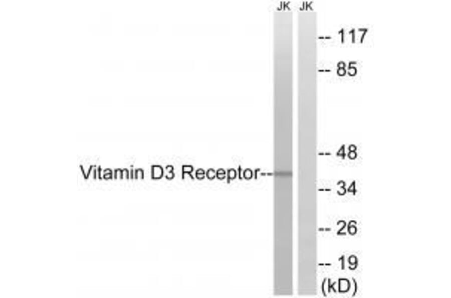Western blot - Vitamin D3 Receptor (Ab-51) Antibody from Signalway Antibody (33256) - Antibodies.com