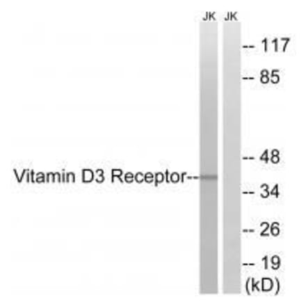 Western blot - Vitamin D3 Receptor (Ab-51) Antibody from Signalway Antibody (33256) - Antibodies.com