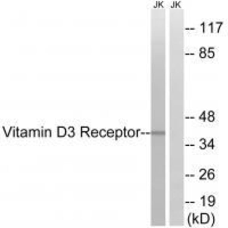 Western blot - Vitamin D3 Receptor (Ab-51) Antibody from Signalway Antibody (33256) - Antibodies.com