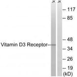 Western blot - Vitamin D3 Receptor (Ab-51) Antibody from Signalway Antibody (33256) - Antibodies.com