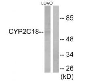 Western blot - Cytochrome P450 2C8/9/18/19 Antibody from Signalway Antibody (34236) - Antibodies.com