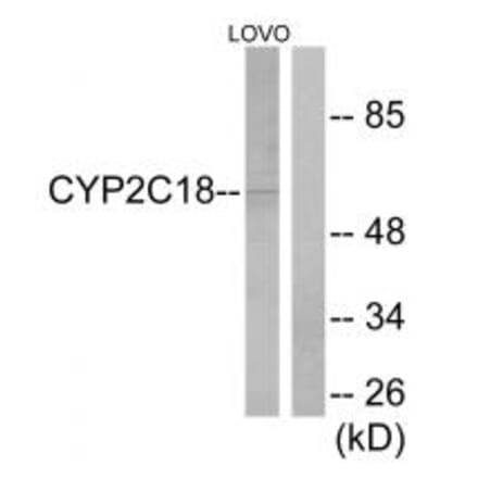 Western blot - Cytochrome P450 2C8/9/18/19 Antibody from Signalway Antibody (34236) - Antibodies.com