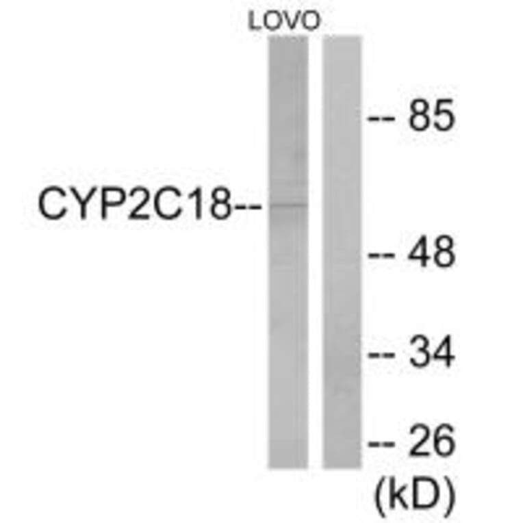 Western blot - Cytochrome P450 2C8/9/18/19 Antibody from Signalway Antibody (34236) - Antibodies.com
