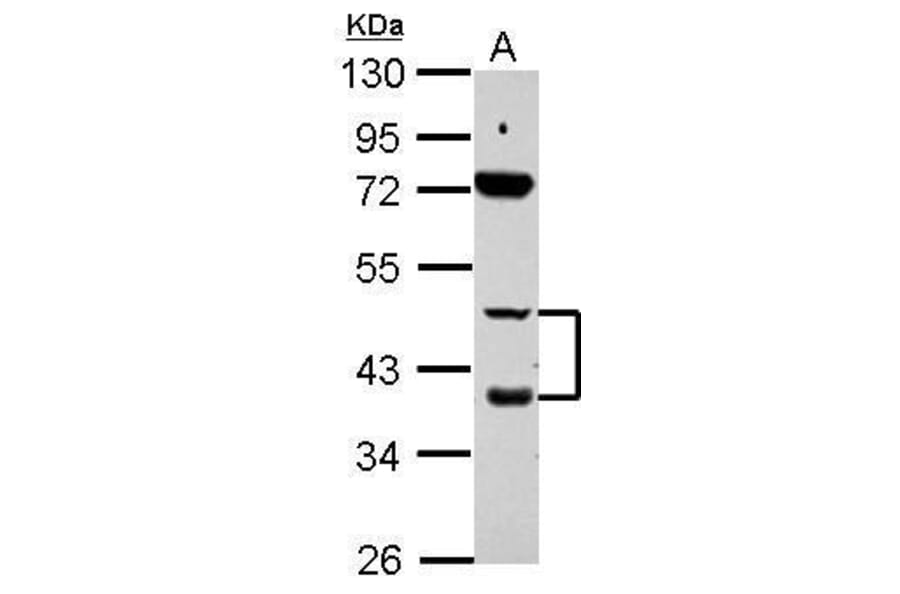 Retinoic Acid Receptor beta Antibody from Signalway Antibody (35347) - Antibodies.com