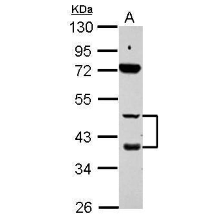 Retinoic Acid Receptor beta Antibody from Signalway Antibody (35347) - Antibodies.com