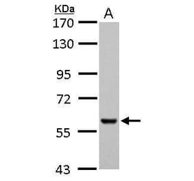 Pyruvate Kinase (liver/RBC) Antibody from Signalway Antibody (35442) - Antibodies.com