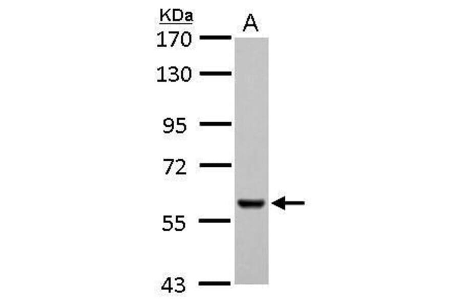 Pyruvate Kinase (liver/RBC) Antibody from Signalway Antibody (35442) - Antibodies.com