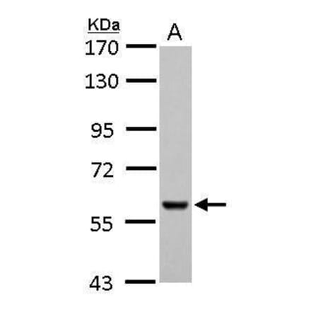 Pyruvate Kinase (liver/RBC) Antibody from Signalway Antibody (35442) - Antibodies.com