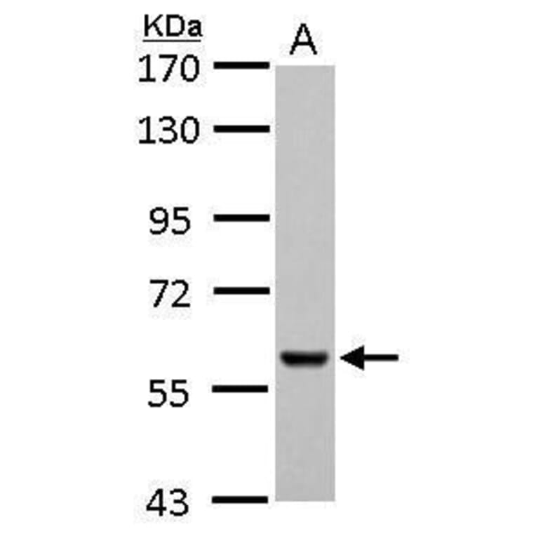 Pyruvate Kinase (liver/RBC) Antibody from Signalway Antibody (35442) - Antibodies.com