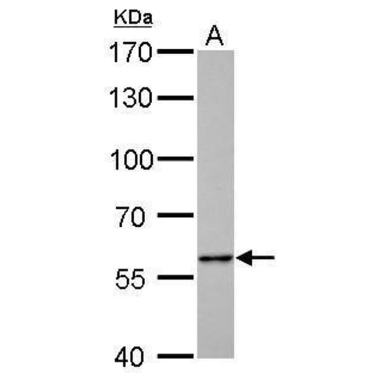 Pyruvate Kinase (liver/RBC) Antibody from Signalway Antibody (35442) - Antibodies.com