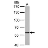 Pyruvate Kinase (liver/RBC) Antibody from Signalway Antibody (35442) - Antibodies.com