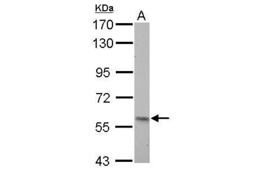 Pyruvate Kinase (liver/RBC) Antibody from Signalway Antibody (35442) - Antibodies.com