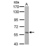 Pyruvate Kinase (liver/RBC) Antibody from Signalway Antibody (35442) - Antibodies.com