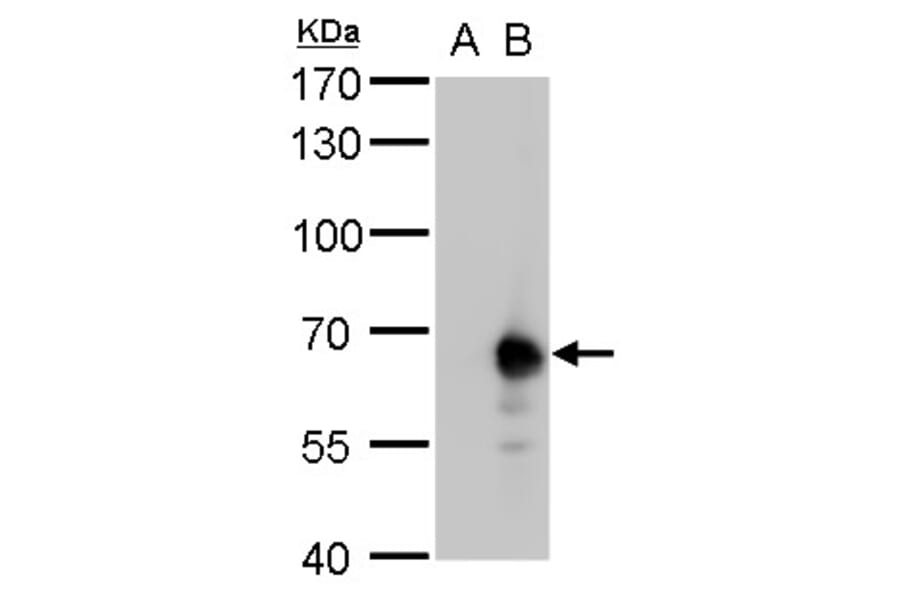 Pyruvate Kinase (liver/RBC) Antibody from Signalway Antibody (35442) - Antibodies.com