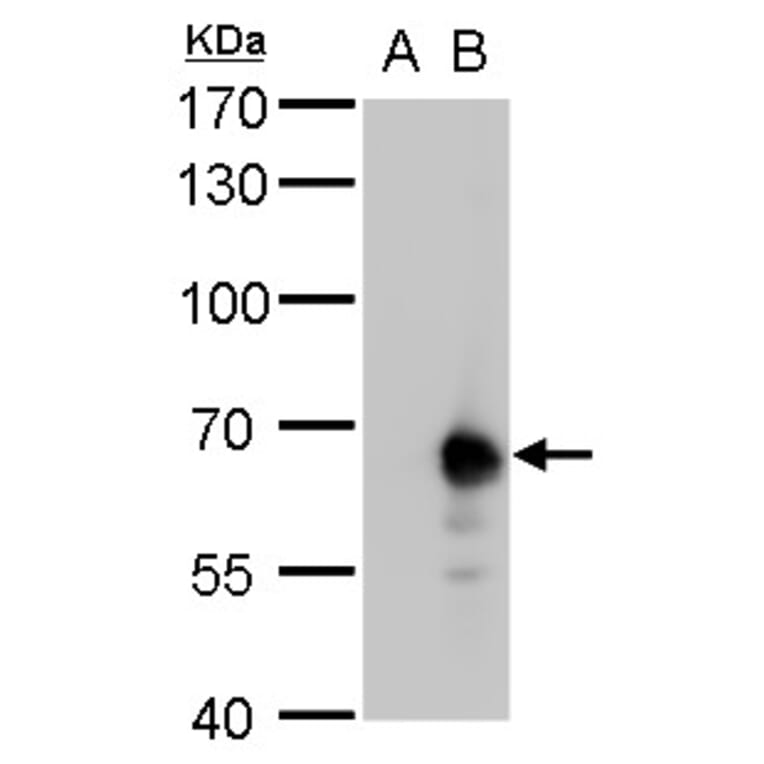 Pyruvate Kinase (liver/RBC) Antibody from Signalway Antibody (35442) - Antibodies.com