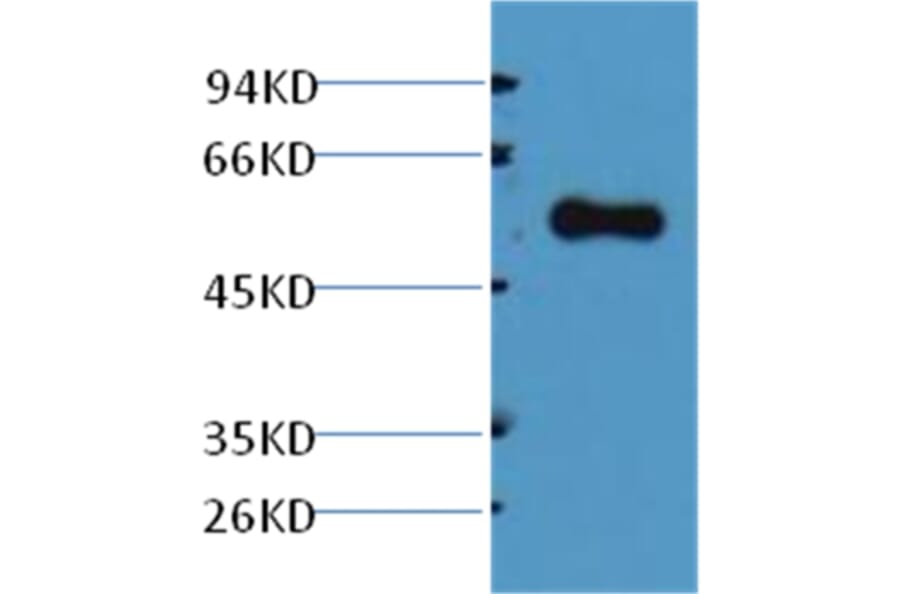 Western blot - Alliinase Rabbit Polyclonal Antibody from Signalway Antibody (38042) - Antibodies.com