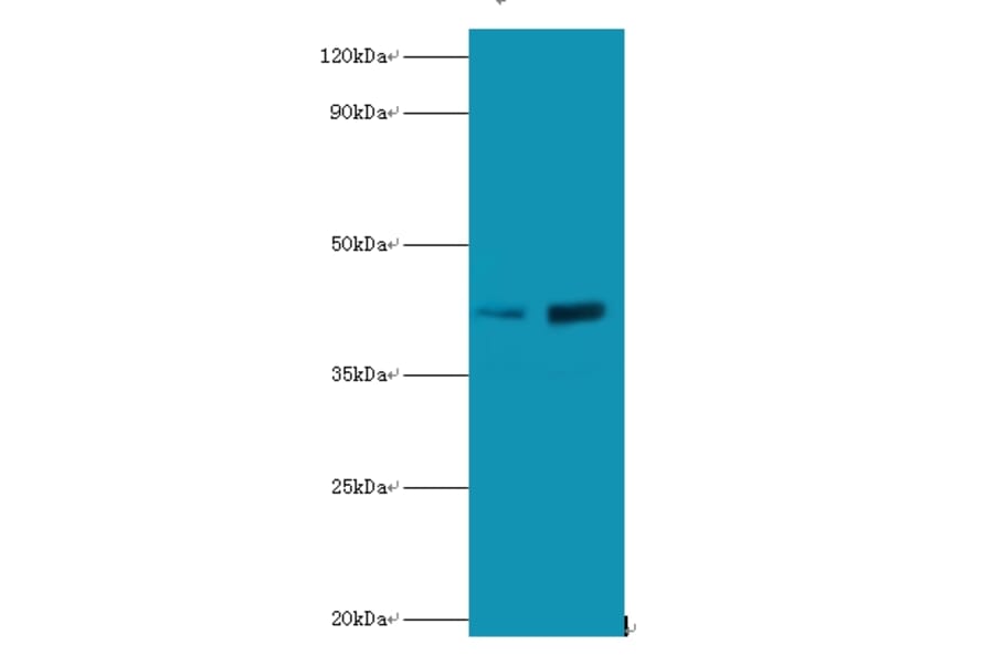 Lupus La protein Polyclonal Antibody from Signalway Antibody (42333) - Antibodies.com