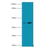 Lupus La protein Polyclonal Antibody from Signalway Antibody (42333) - Antibodies.com