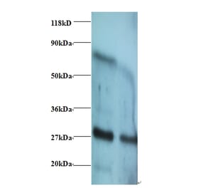 Interferon gamma Polyclonal Antibody from Signalway Antibody (42460) - Antibodies.com