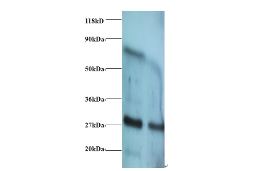 Interferon gamma Polyclonal Antibody from Signalway Antibody (42460) - Antibodies.com
