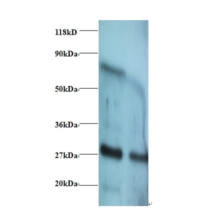 Interferon gamma Polyclonal Antibody from Signalway Antibody (42460) - Antibodies.com