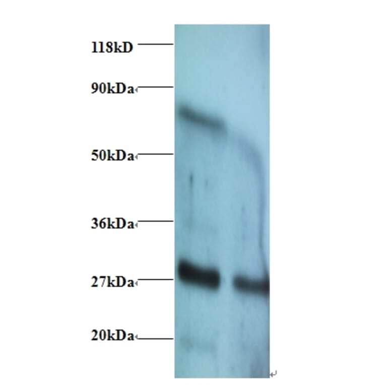 Interferon gamma Polyclonal Antibody from Signalway Antibody (42460) - Antibodies.com
