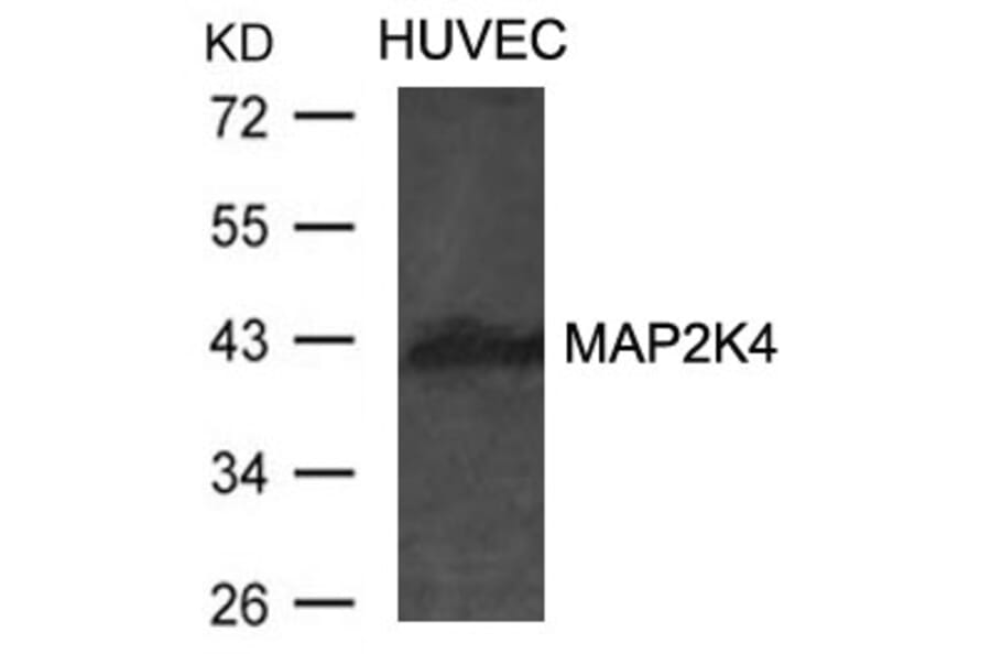Western blot - MAP2K4 Antibody from Signalway Antibody (21441) - Antibodies.com