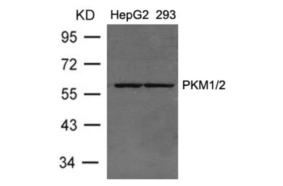 Western blot - PKM1/2 Antibody from Signalway Antibody (21456) - Antibodies.com