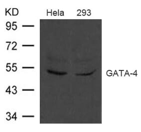 Western blot - GATA-4 Antibody from Signalway Antibody (21496) - Antibodies.com