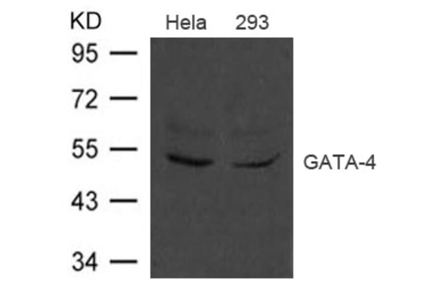 Western blot - GATA-4 Antibody from Signalway Antibody (21496) - Antibodies.com