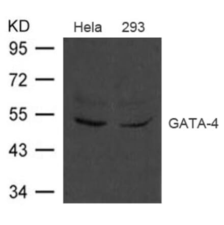 Western blot - GATA-4 Antibody from Signalway Antibody (21496) - Antibodies.com
