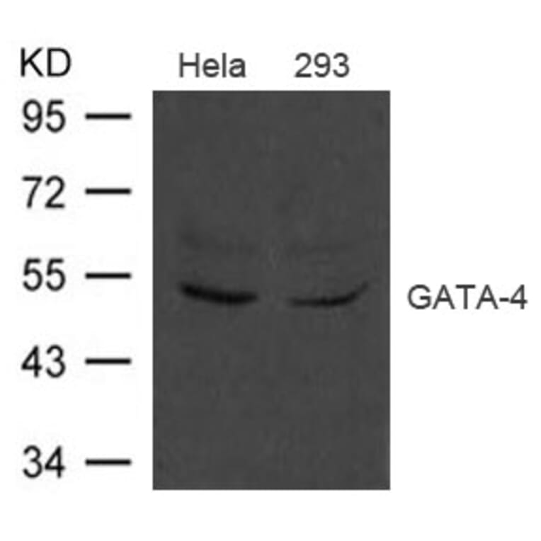 Western blot - GATA-4 Antibody from Signalway Antibody (21496) - Antibodies.com