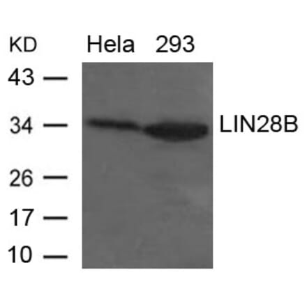 Western blot - LIN28B Antibody from Signalway Antibody (21626) - Antibodies.com