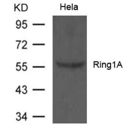 Western blot - Ring1A Antibody from Signalway Antibody (21629) - Antibodies.com