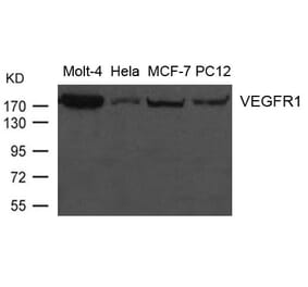 Western blot - VEGFR1 Antibody from Signalway Antibody (21631) - Antibodies.com