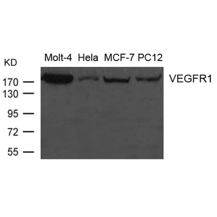 Western blot - VEGFR1 Antibody from Signalway Antibody (21631) - Antibodies.com