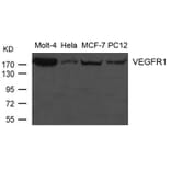 Western blot - VEGFR1 Antibody from Signalway Antibody (21631) - Antibodies.com