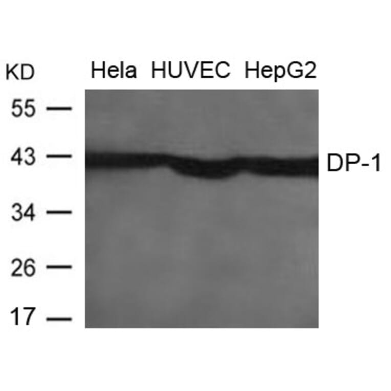 Western blot - DP-1 Antibody from Signalway Antibody (21654) - Antibodies.com