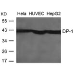 Western blot - DP-1 Antibody from Signalway Antibody (21654) - Antibodies.com