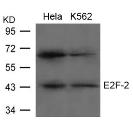 Western blot - E2F-2 Antibody from Signalway Antibody (21657) - Antibodies.com