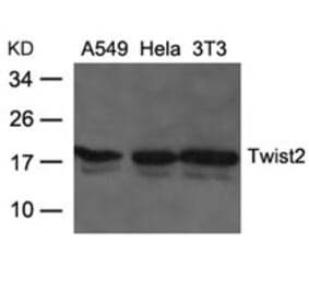 Western blot - Twist2 Antibody from Signalway Antibody (21669) - Antibodies.com