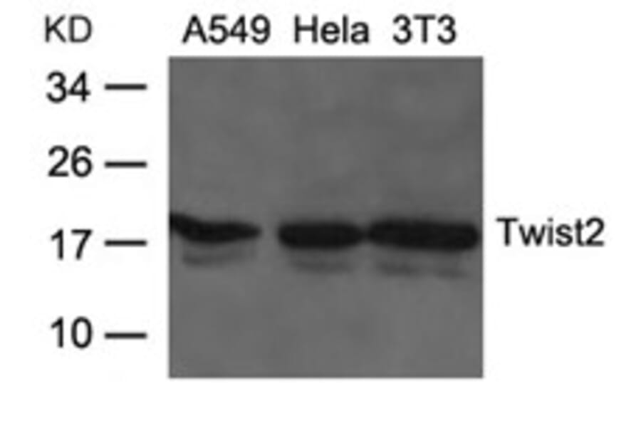 Western blot - Twist2 Antibody from Signalway Antibody (21669) - Antibodies.com