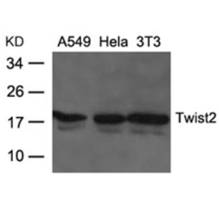 Western blot - Twist2 Antibody from Signalway Antibody (21669) - Antibodies.com