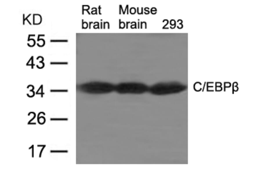 Western blot - C/EBPb Antibody from Signalway Antibody (21675) - Antibodies.com